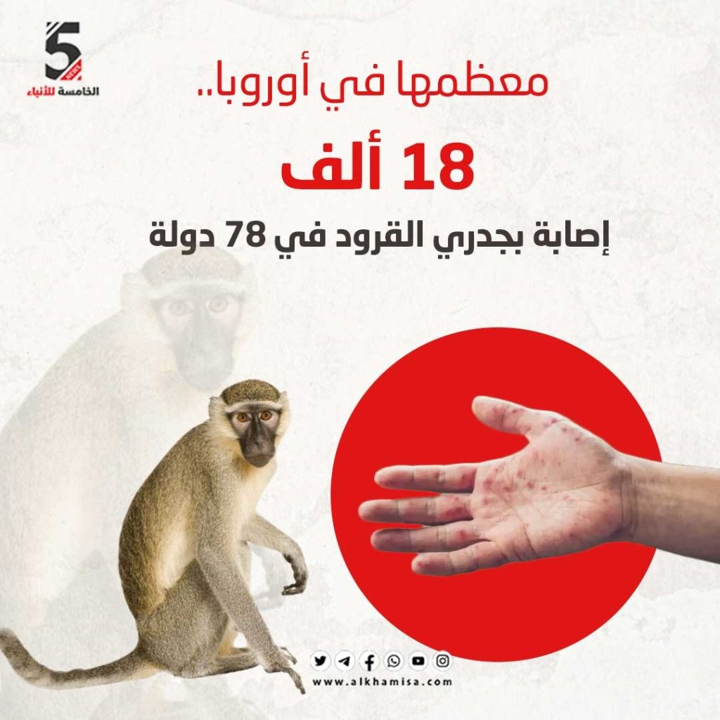 معظمها في أوروبا.. 18 ألف إصابة بجدري القرود في 78 دولة