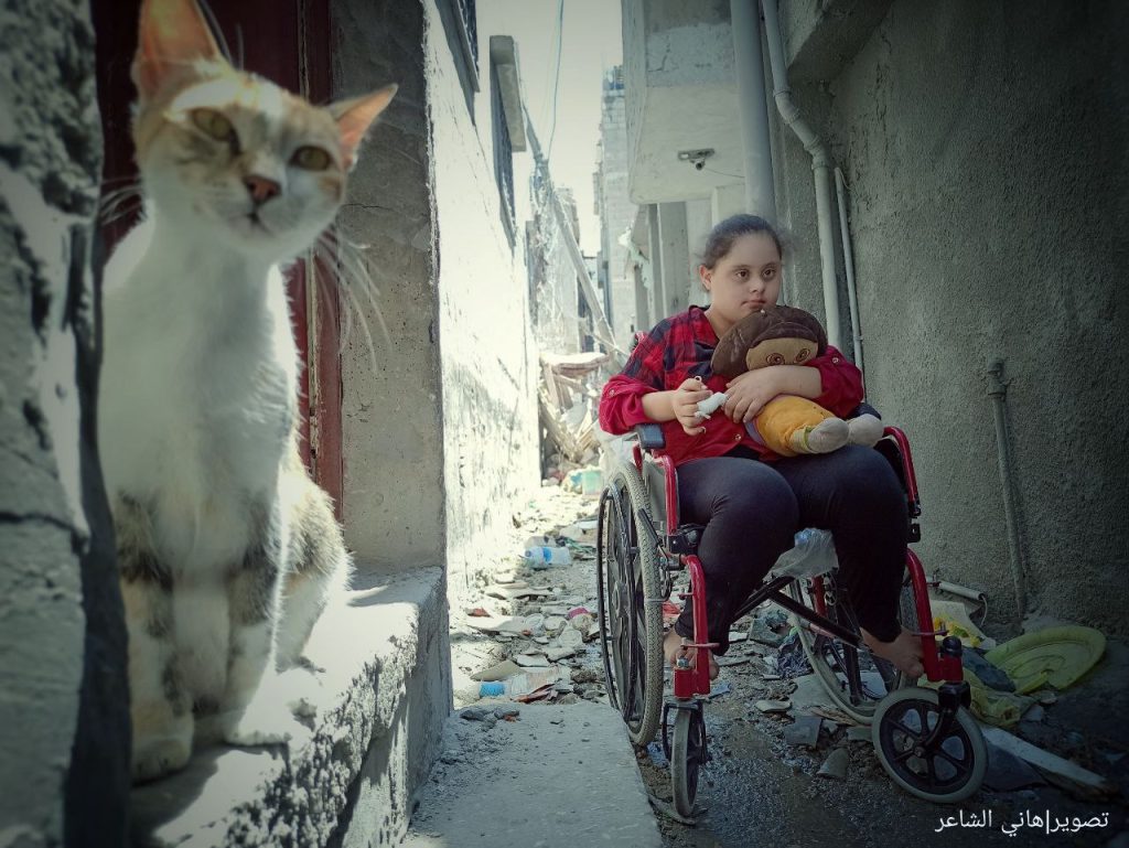 📷"حلا فلفل".. طفلة من "متلازمة الحب" تفقد غرفتها وألعابها وكرسيها المتحرك إثر قصف الاحتلال لمنزلها
