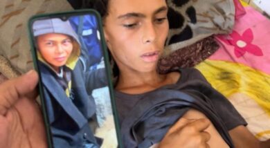 وفاة فتى بسبب سوء التغذية بغزة