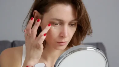 الوخز بالإبر الدقيقة يثبت فعاليته على الهالات الداكنة