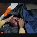 سامر أبو دقة.. حين أصبحت الكاميرا سلاحًا ورفيقًا للشهادة