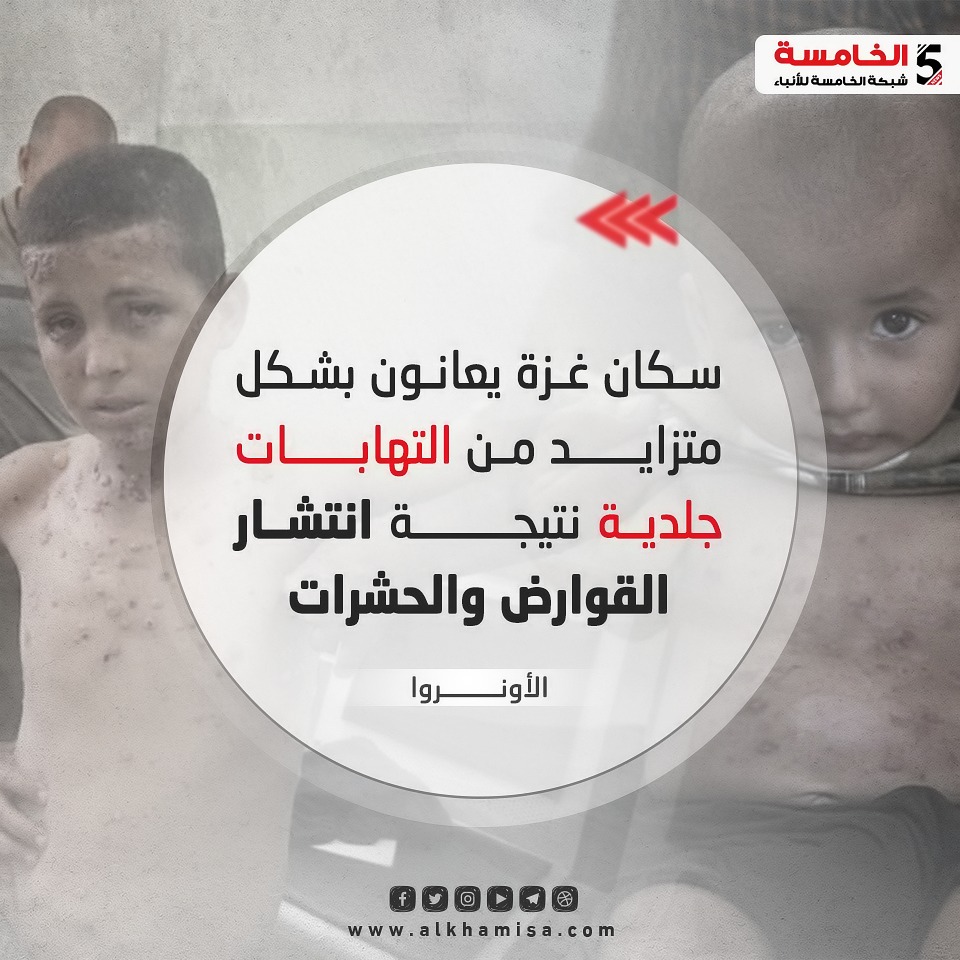 الأونروا