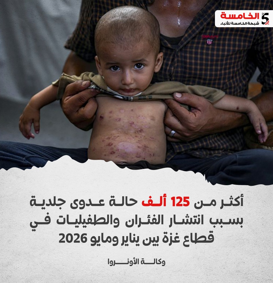 أكثر من 125 ألف حالة عدوى جلدية بسبب انتشار الفئران والطفيليات في قطاع غزة بين يناير ومايو 2026