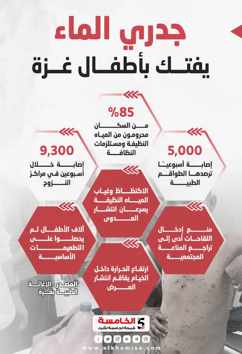 جدري الماء