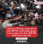 سوء التغذية