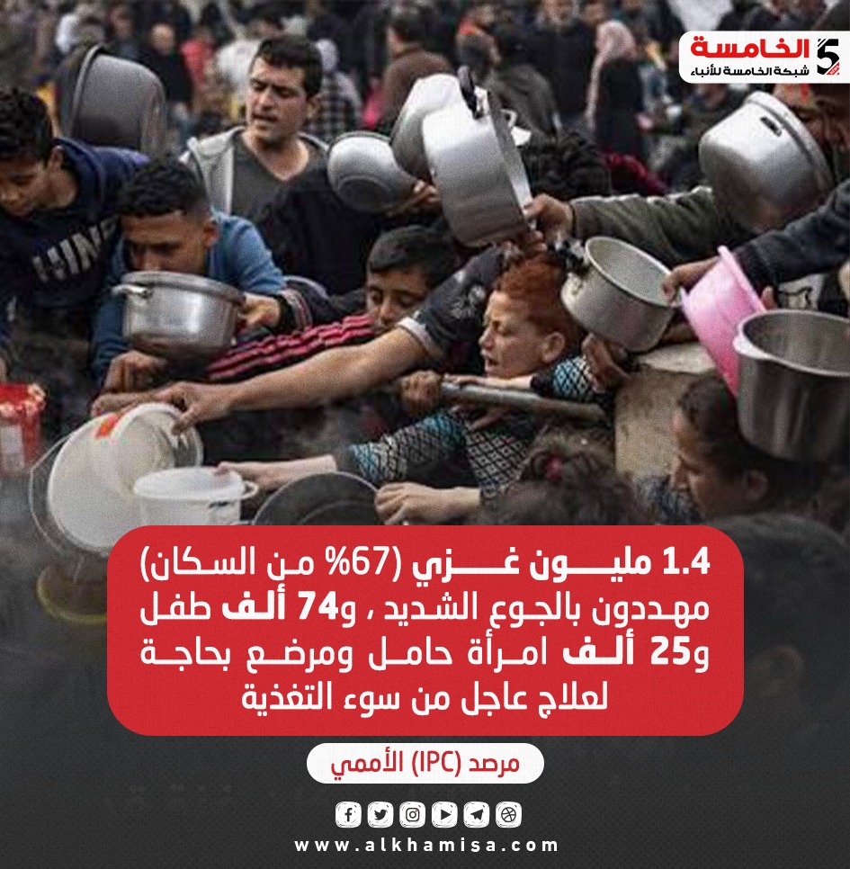سوء التغذية