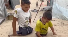 8 آلاف مبتور في غزة.. نقص المواد يعرقل تركيب الأطراف الصناعية