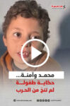 محمد وآمنة... حكاية طفولة لم تنج من الحرب