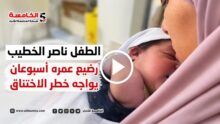 الطفل ناصر الخطيب.. رضيع عمره أسبوعان يواجه خطر الاختناق