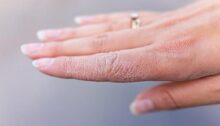 أعراض نقص الزنك.. 10 علامات تظهر على الجسم